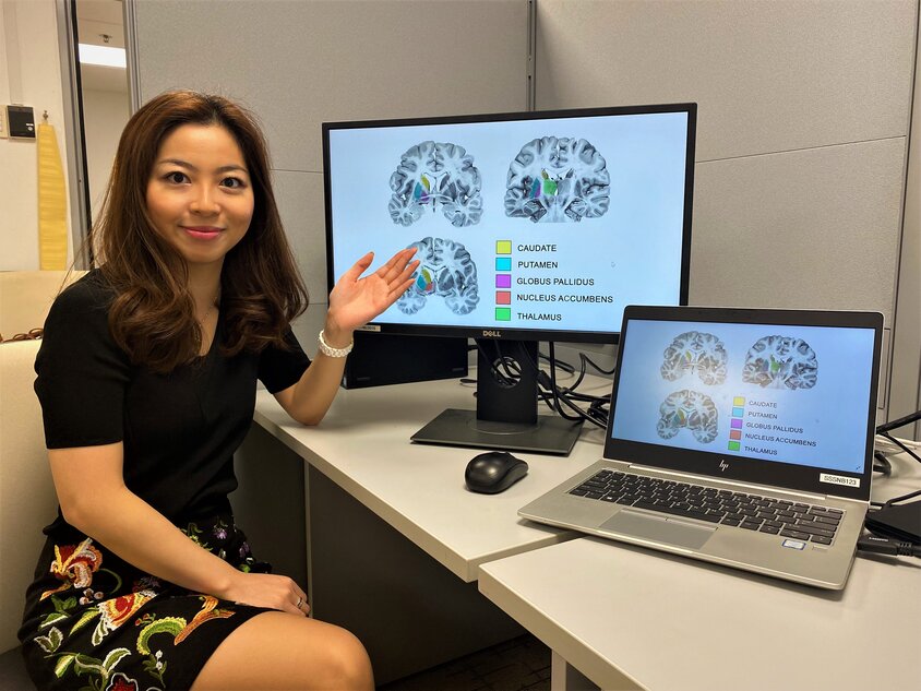 Assistant Professor Olivia Choy showing that psychopaths have larger striatum region in the brain