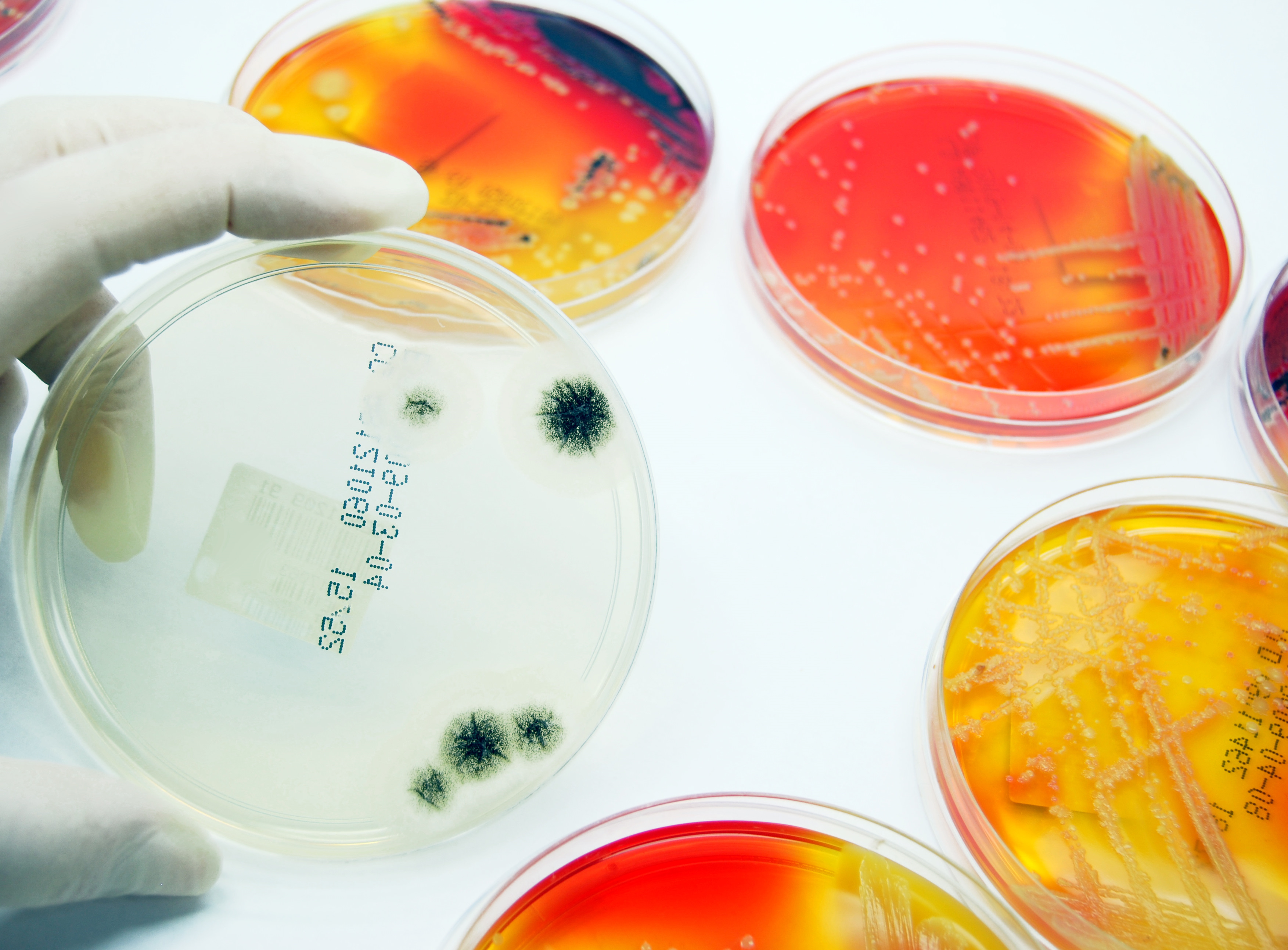 Microbiology Fungal culture in the foreground