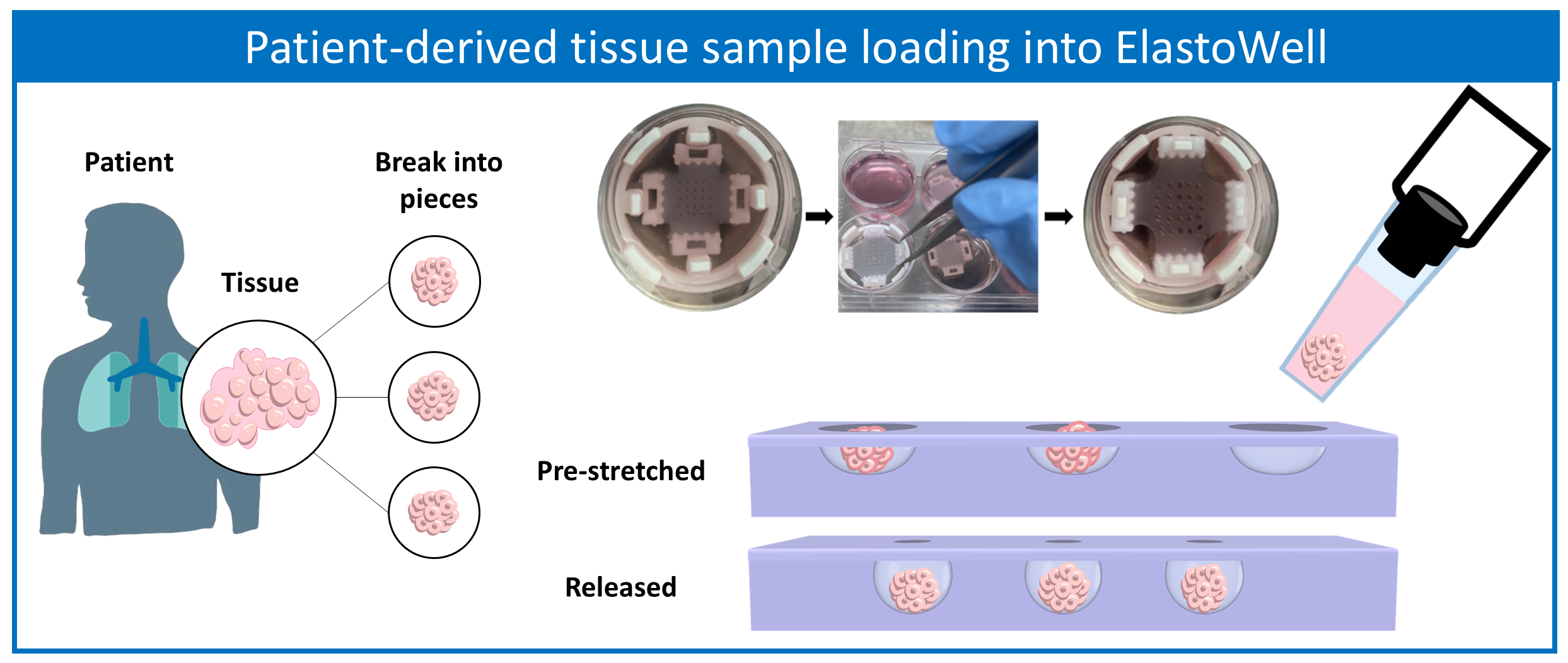 ElastoWell_Image_Patient-derived tissue sample