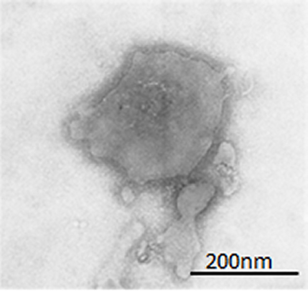 Electron microscope image of a respiratory syncytial virus 