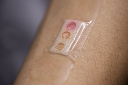 Plaster-like microlaser device measures glucose levels in sweat accurately