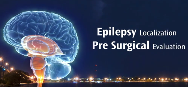 Brain with text on Epilepsy