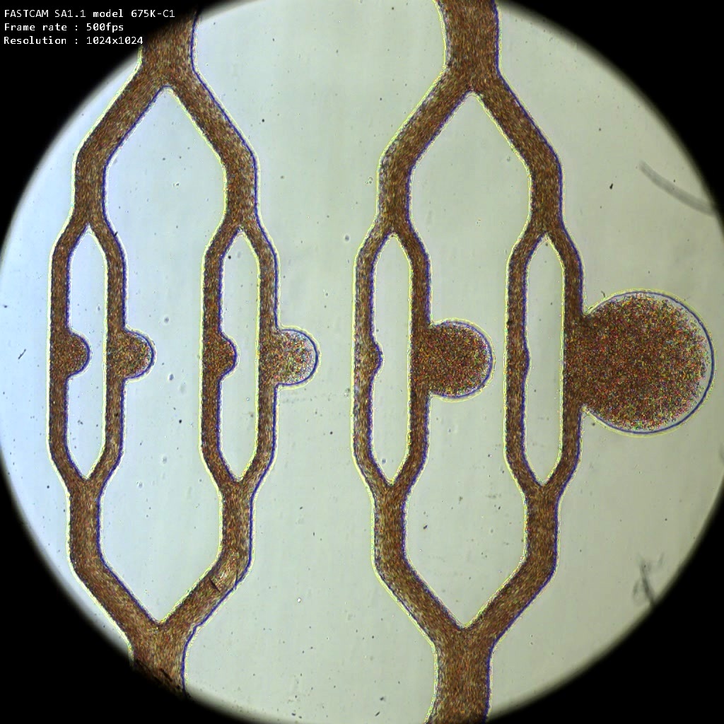 microaneurysm on a chip