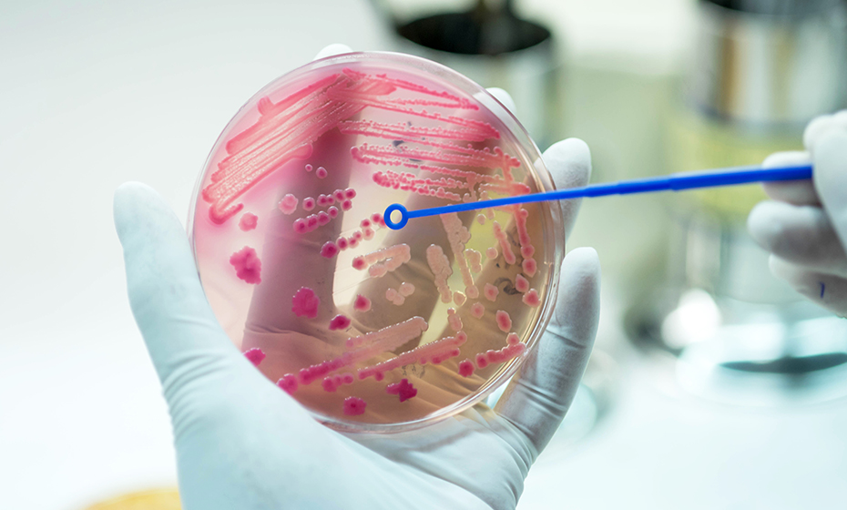 Antimicrobial Peptides