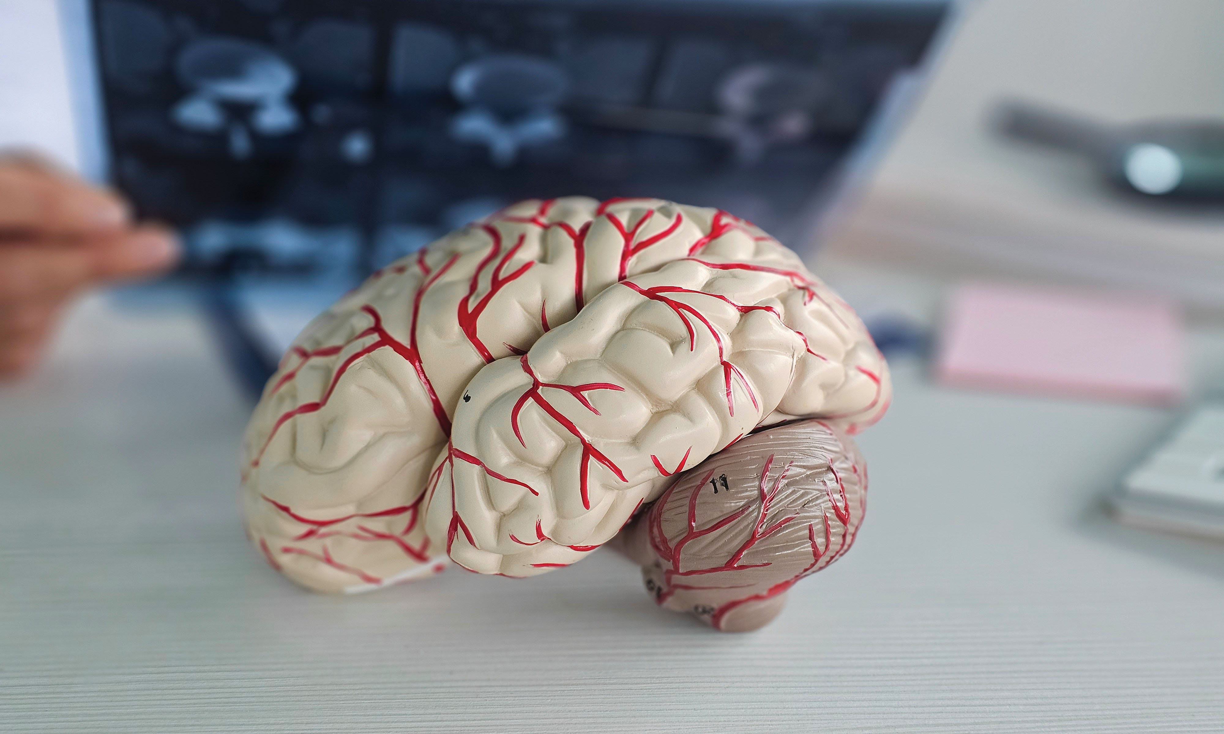 Model of brain