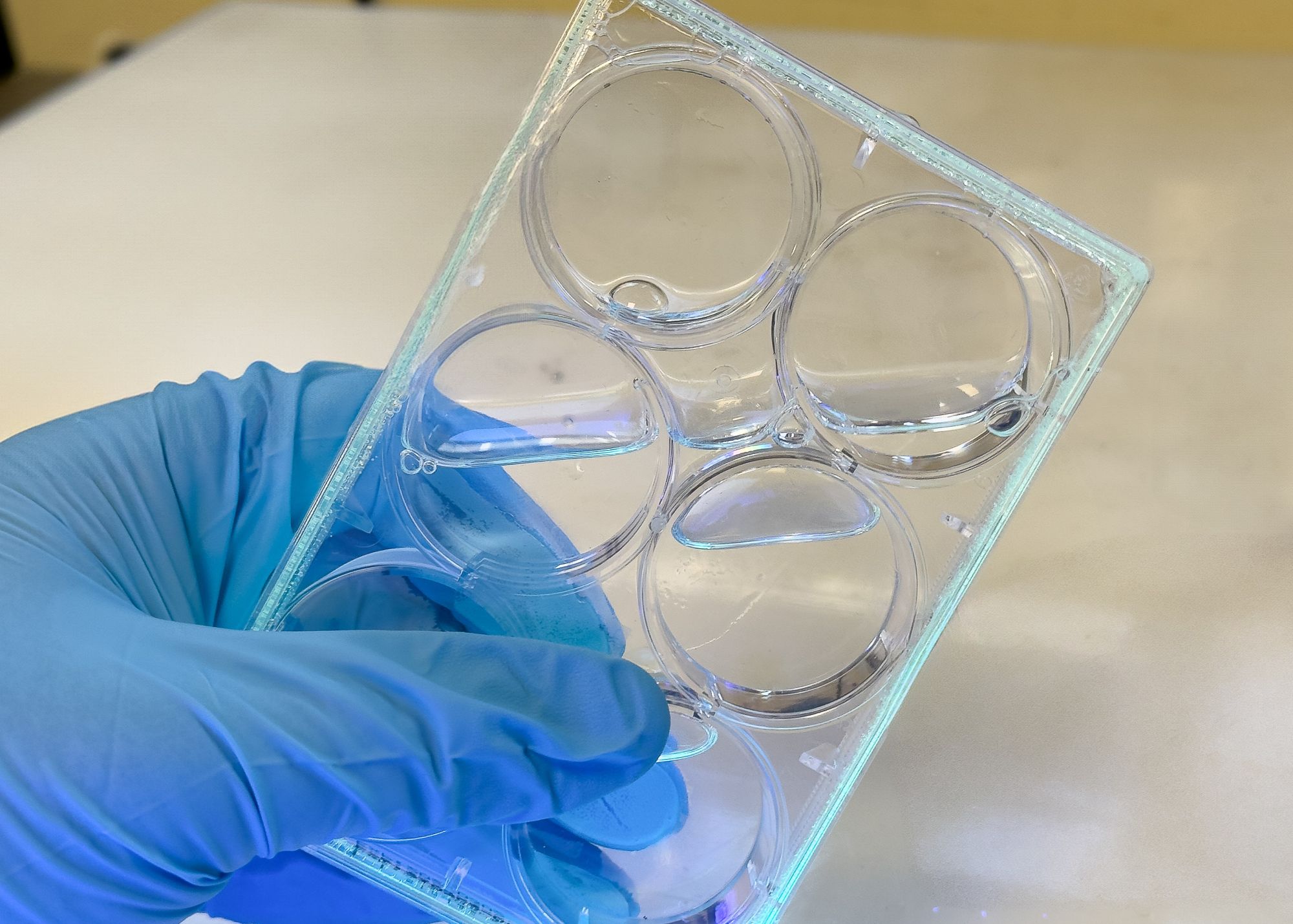 A form-in-place gasket is cured instantly with a handheld UV light to create a water-tight seal, showcasing the material's utility for custom sealants and biomedical devices. Credit: NTU Singapore