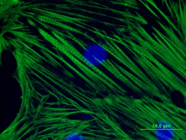 Fluorescence microscopy image of human pluripotent stem cell-derived cardiovascular progenitor cells