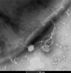 Jabs attached to M. abscessus Transmission electron micrograph of a bacteriophage attached to M. abscessus