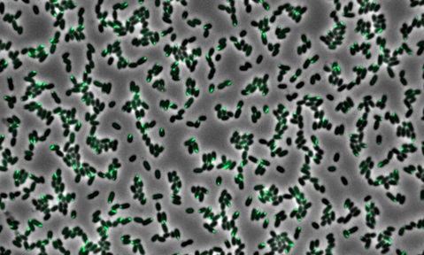 Pseudomonas aeruginosa with their Type VI Secretion System (T6SS), which is akin to a molecular speargun, in green fluorescence.