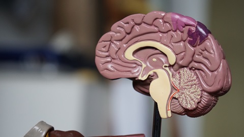neuroimaging, psychiatric research, psychopathy