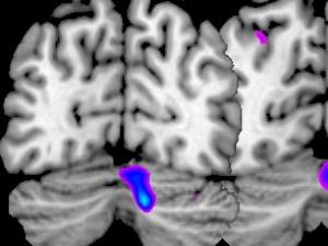 clinical brain lab