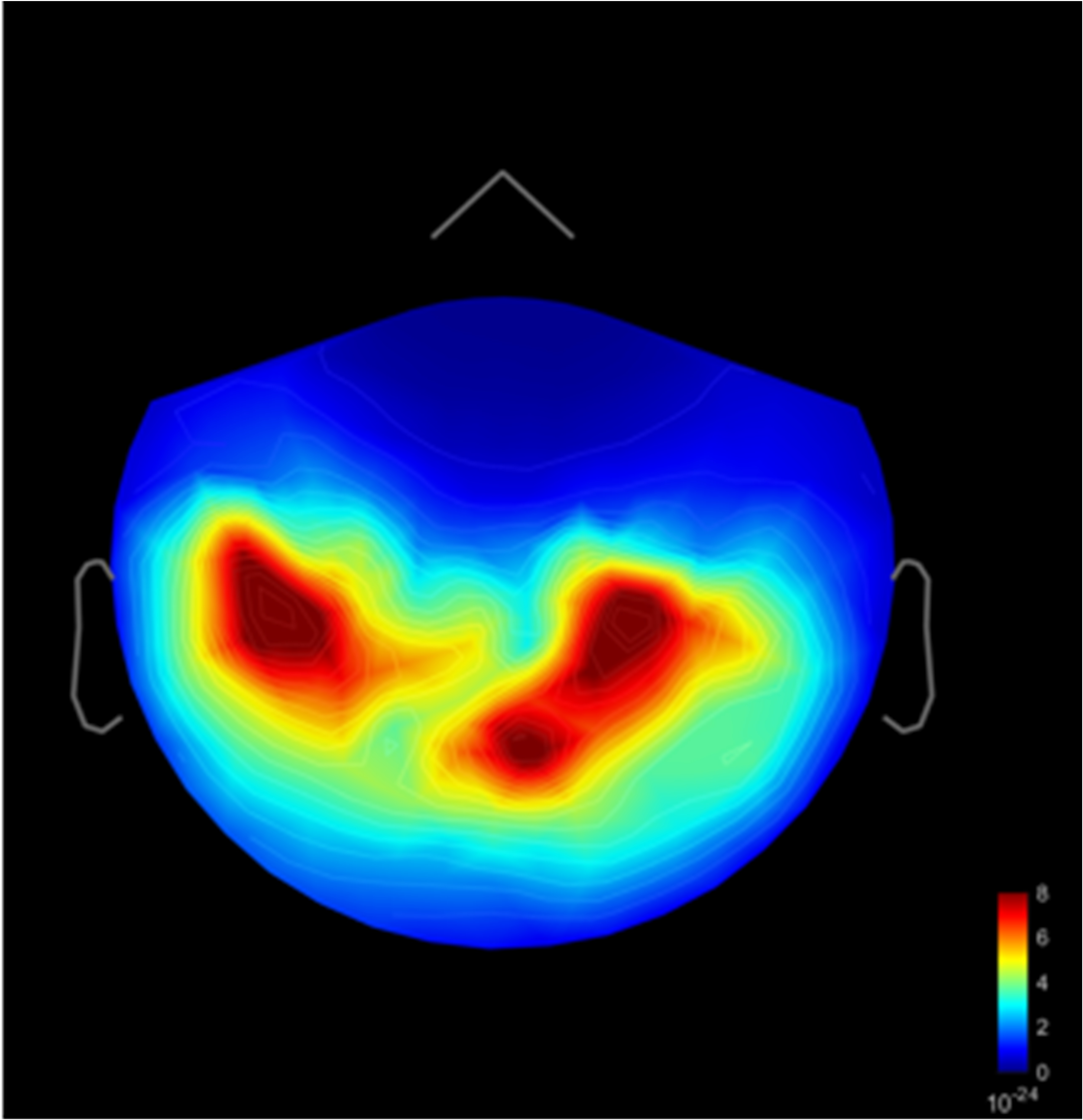 Brain scan MEG