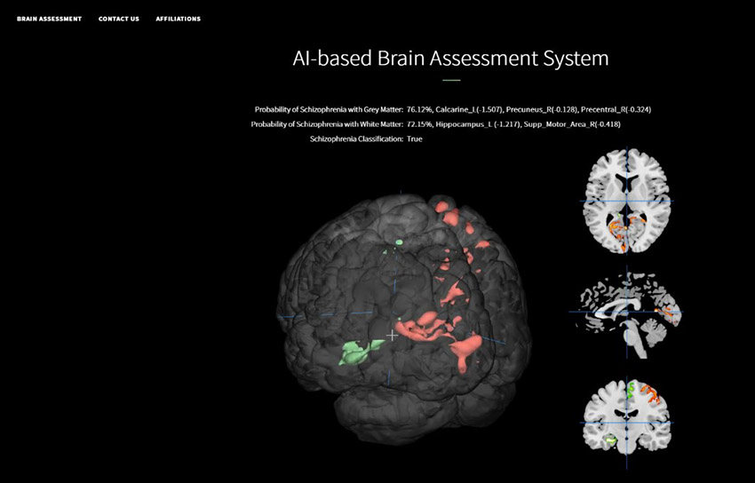 BrainProbe