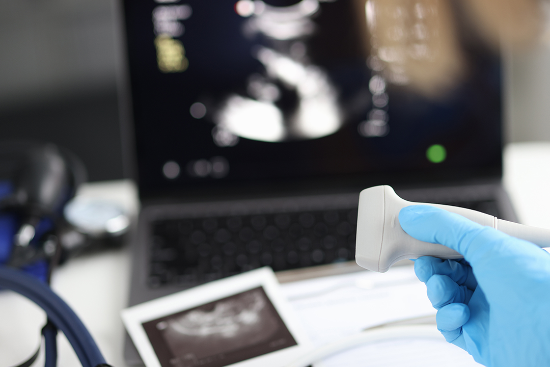 doctor-holds-ultrasonic-probe-hand-preparing-device-examination