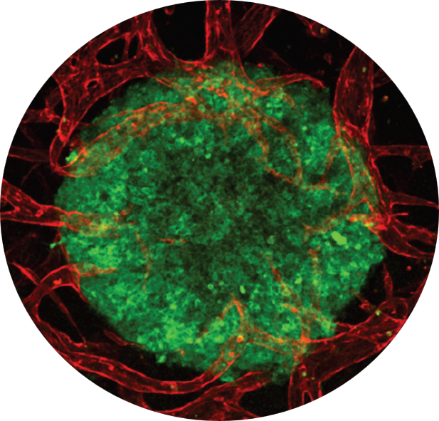 cancer discovery