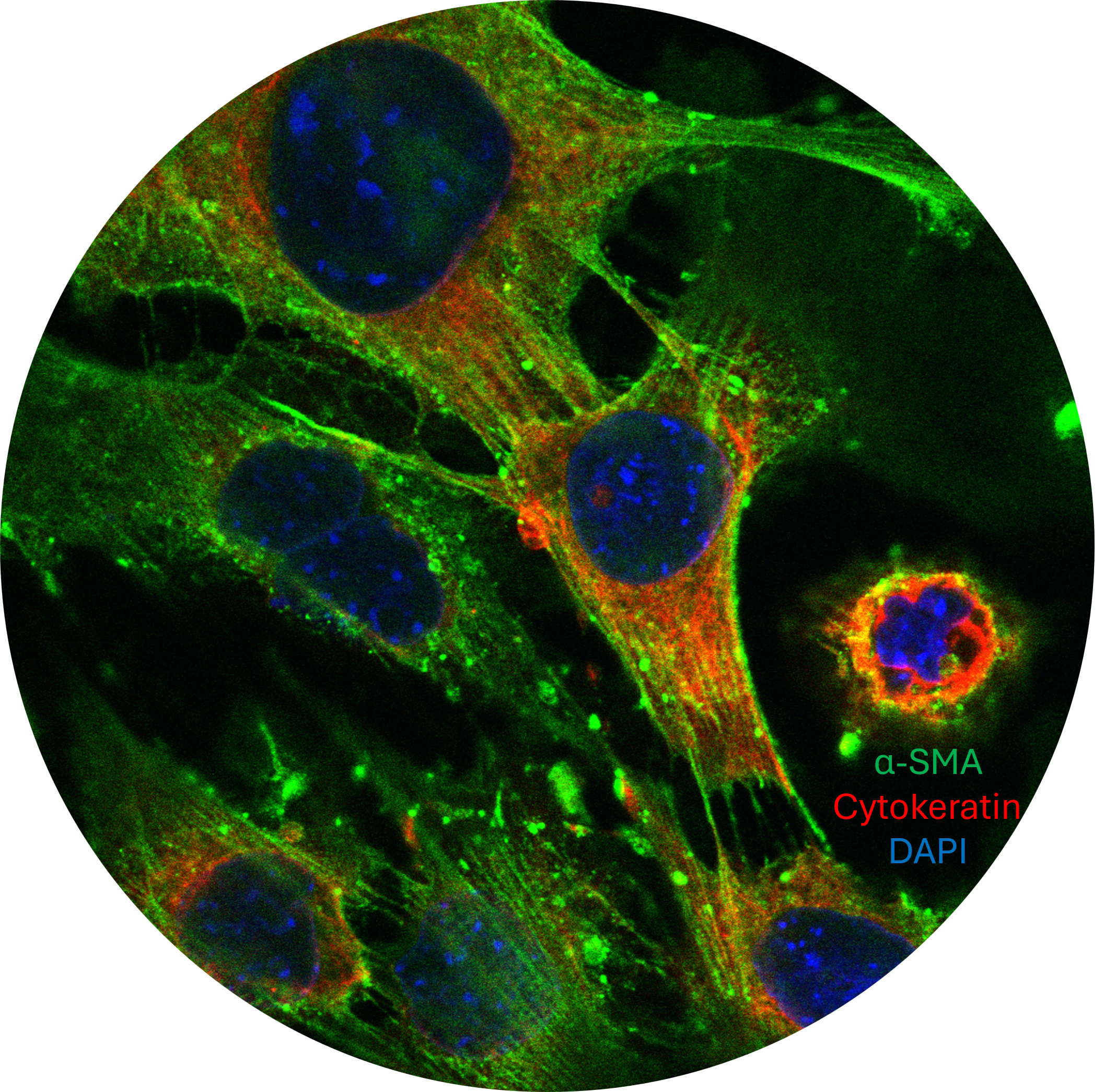 cancer discovery
