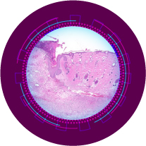 skin 2