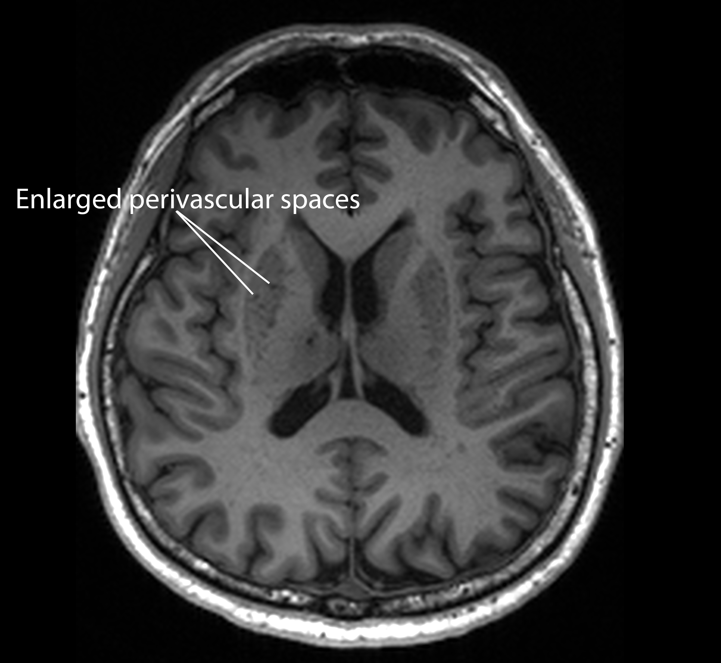 MRI 2025