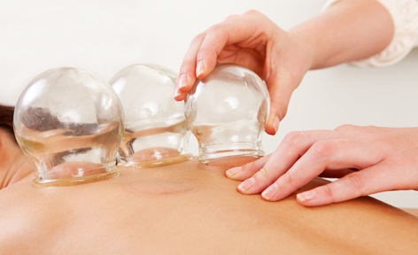 Cupping